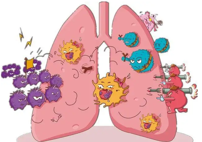 杭州御和堂中医：肺癌发病与哪些因素有关？