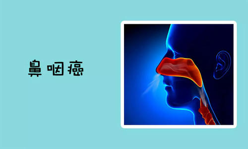 鼻咽癌的治疗方法！